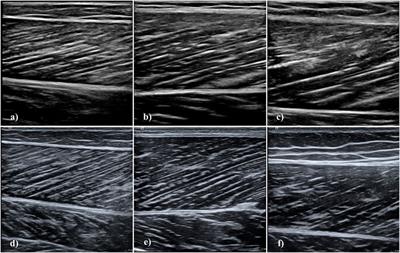 Agreement and reliability of lower limb muscle architecture measurements using a portable ultrasound device